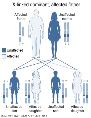 Image showing inheritance of X-linked dominant mutation from an affected father, The sons of a man with an X-linked dominant 
