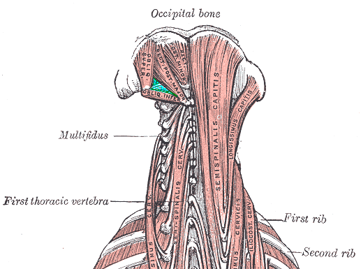 <p>Deep Posterior Neck Muscles