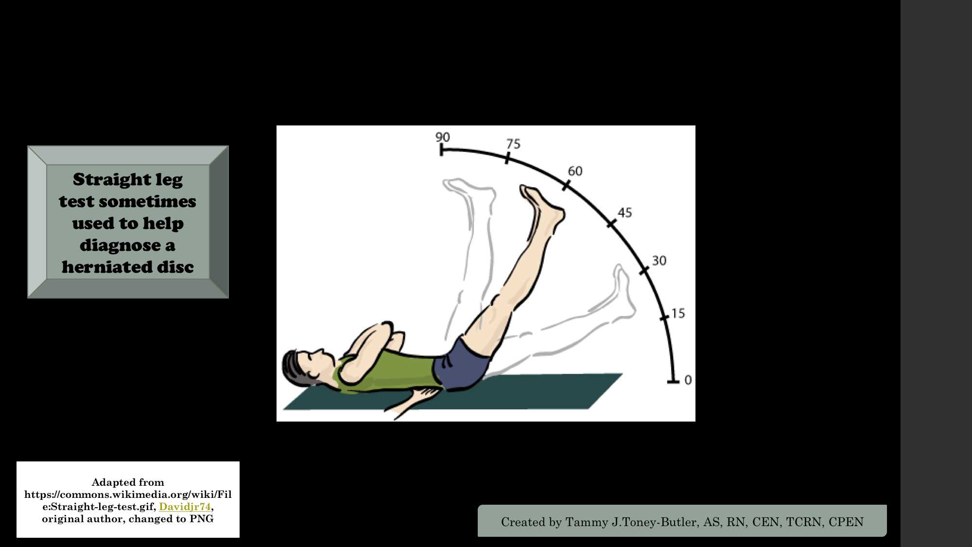 <p>Straight Leg Test. The straight leg test is sometimes used to help diagnose a herniated disc</p>