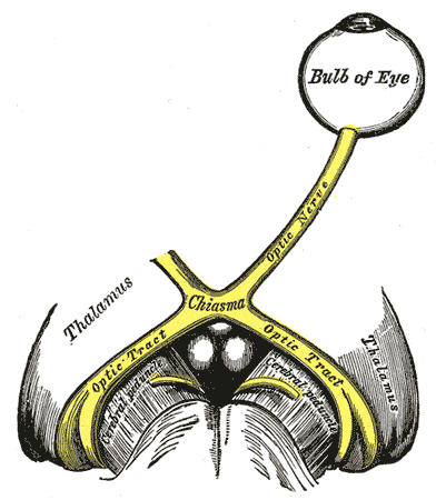 The left optic nerve and the optic tracts
