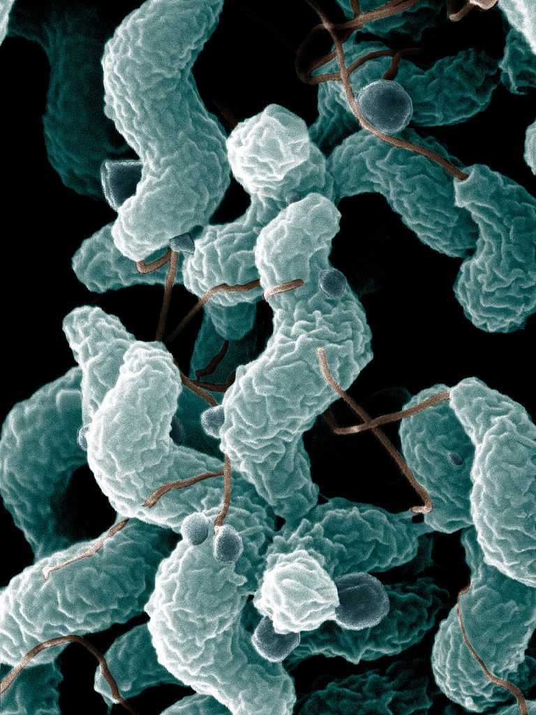 A scanning electron microscope-derived image of Campylobacter jejuni, which triggers about 30% of cases of Guillain–Barré syndrome