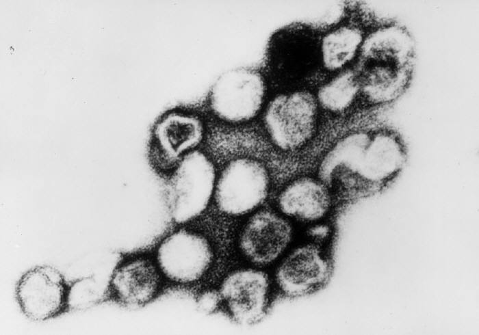 <p>Transmission Electron Micrograph of Rubella Virus.</p>