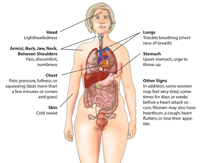 <p>Myocardial Infarction (Heart Attack)&nbsp;Warning Signs in Women.</p>