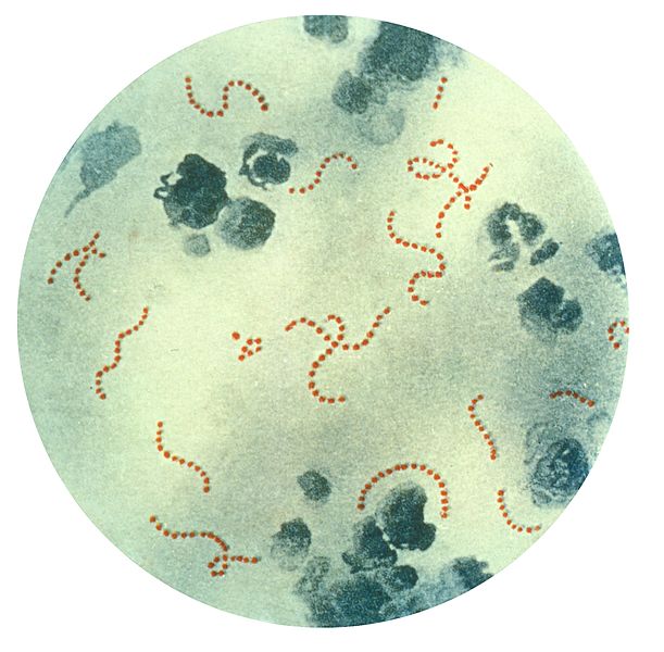 <p><em>Streptococcus Pyogenes </em>Bacteria