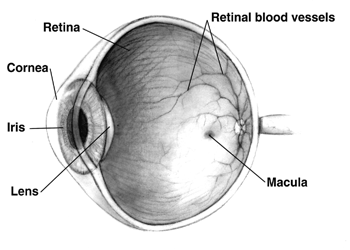 Cross-sectional view, Human Eye, Iris, Lense, Cornea, Retina, Retinal Blood Vessels, Macula, Cataract
