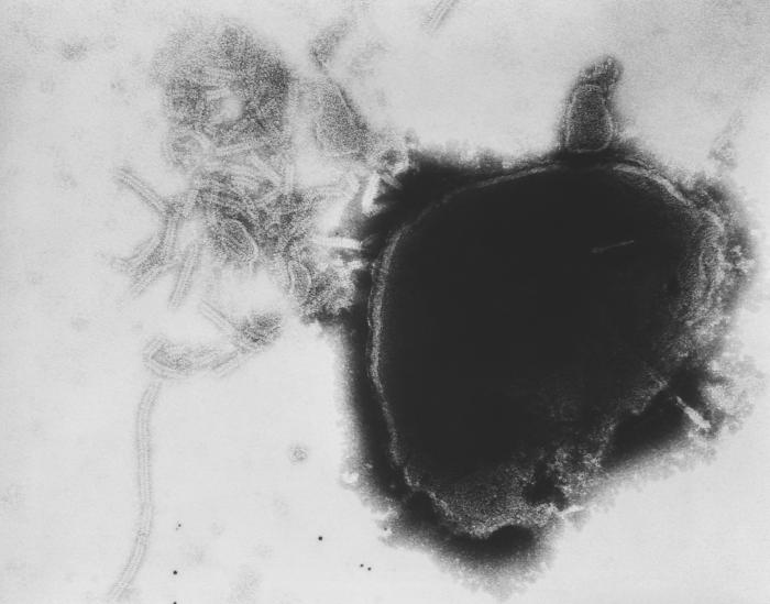 <p>Paramyxovirus Virion Under TEM
