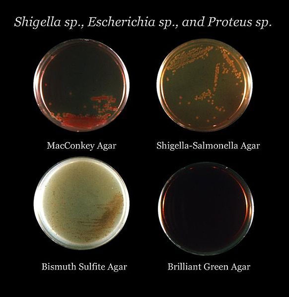 Four Different agar media culture inoculated with Shigella sp