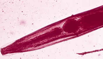 Anterior, Enterobius Vermicularis, pin worm