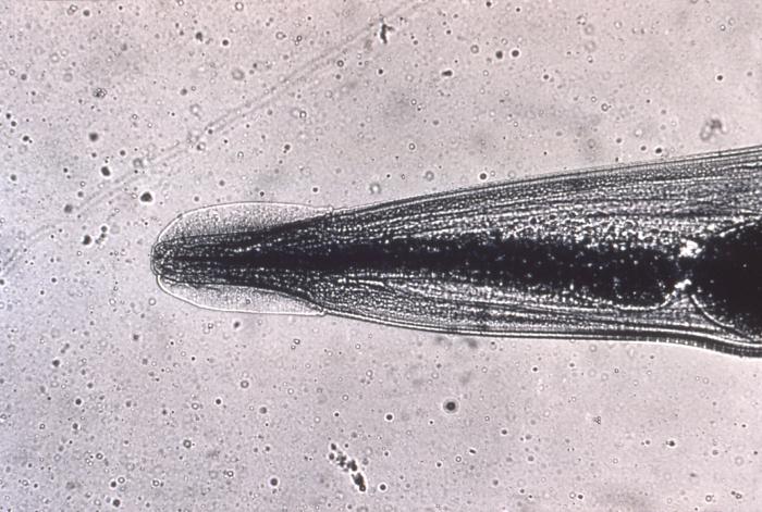 Head, Enterobius Vermicularis, Pinworm