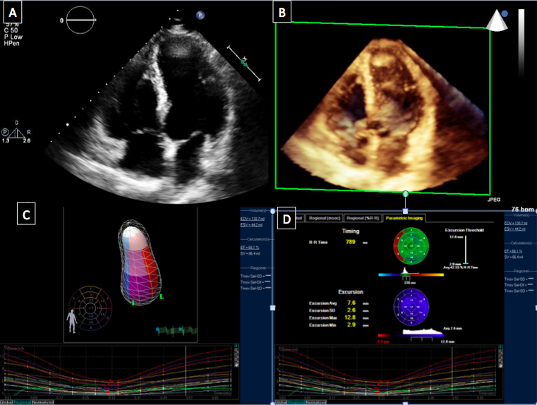 Echocardiography is central to cardiac imaging