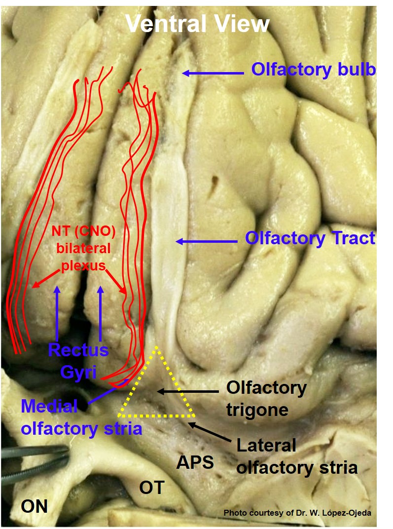 Basal view of a human brain dissection depicting the location of CN0 plexiform fibers over the medial surface of gyri recti