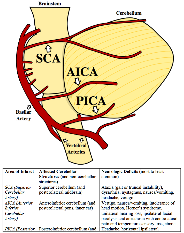 <p>Cerebellar Arteries and Distribution