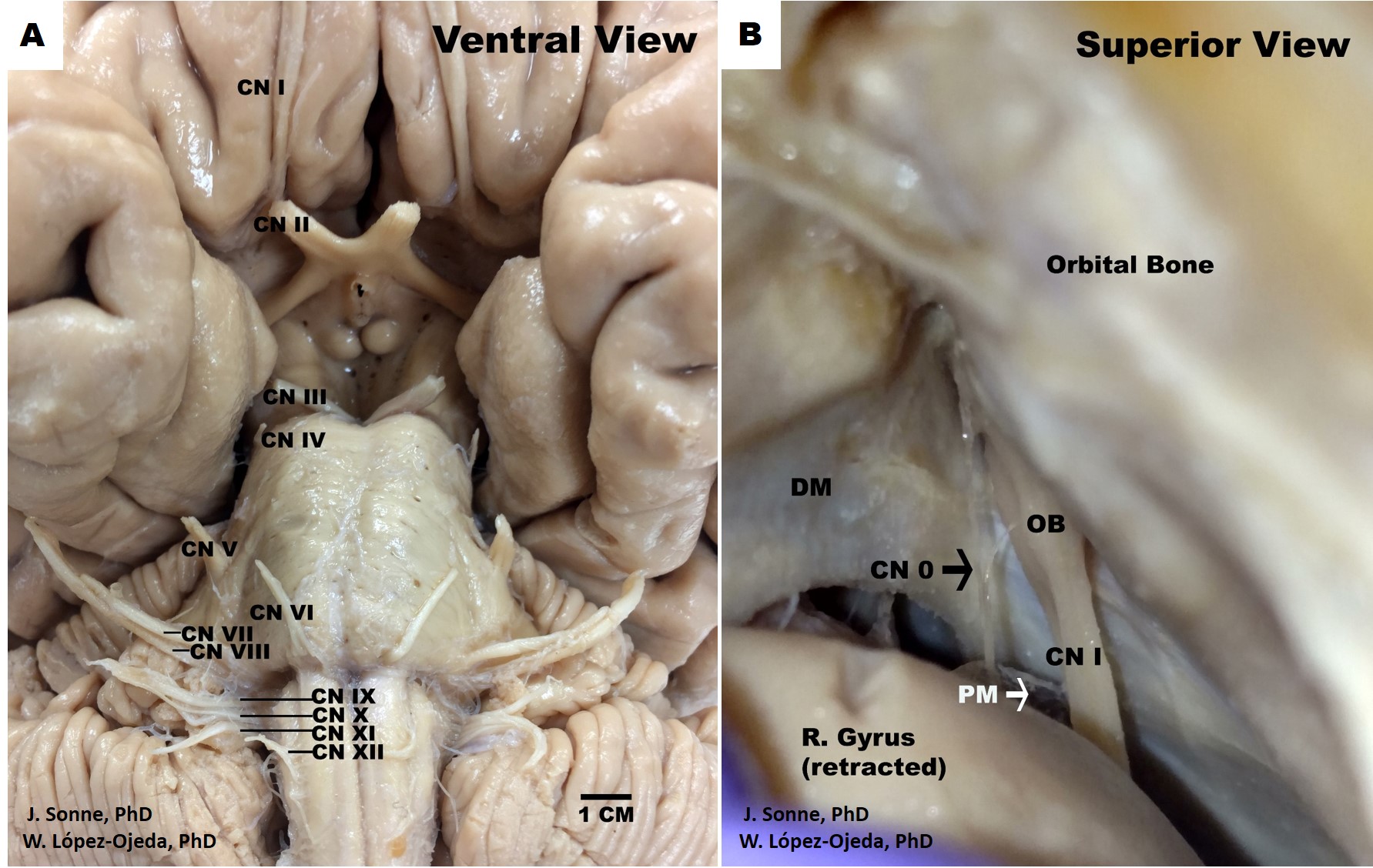<p>Human Brain Cranial Nerves