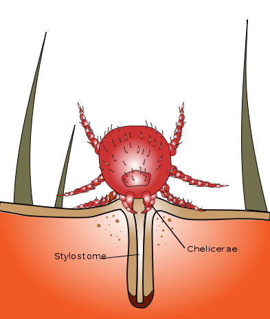 <p>Chigger Stylostome. Illustration of a chigger using its stylostome during feeding.</p>