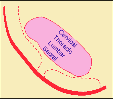 The picture above illustrates the somatopic arrangement of the spinothalamic tract in the spinal cord