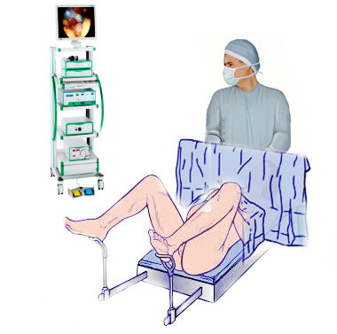 <p>Lithotomy Position</p>
