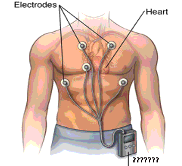 <p>Holter Monitor