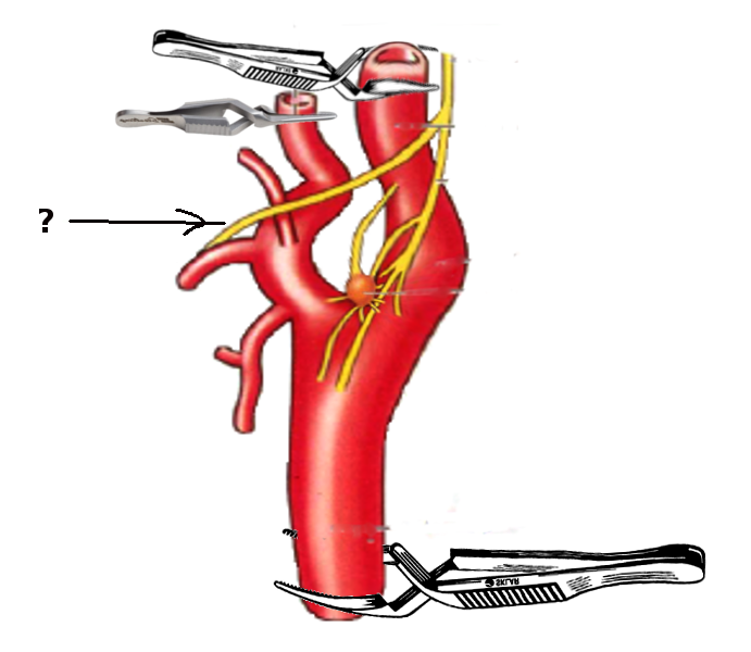 Carotid artery and nerves