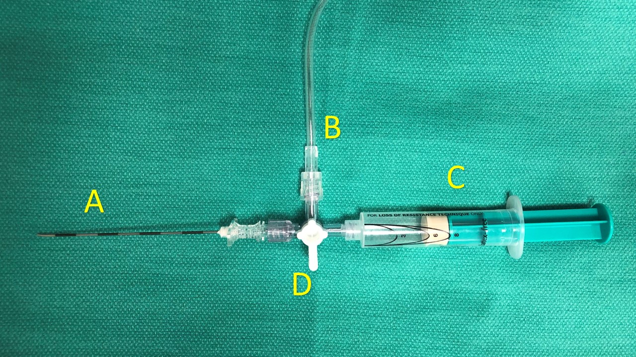 This image depicts an arrangement of components that may be used for placement of an interpleural catheter