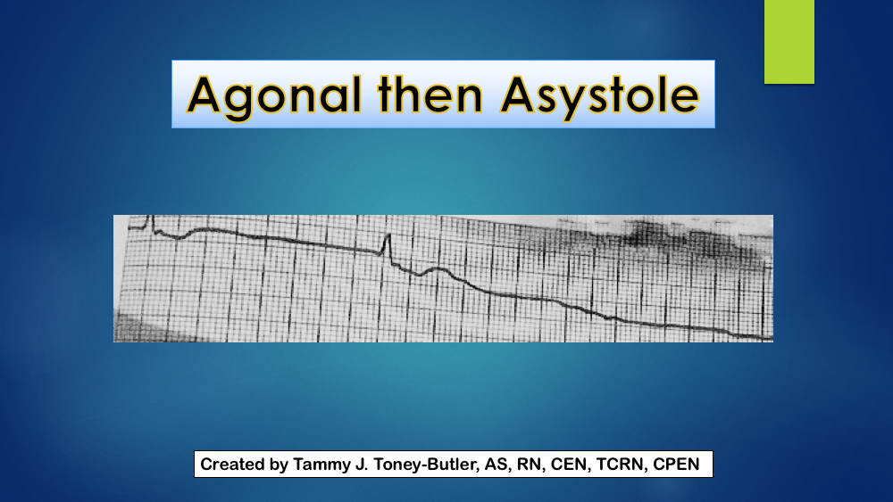 <p>Agonal then Asystole Cardiac Rhythm Strip