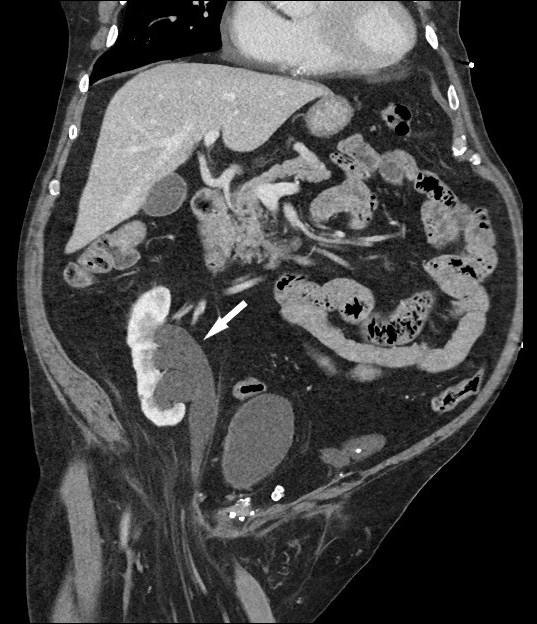 CT of the abdomen and pelvis