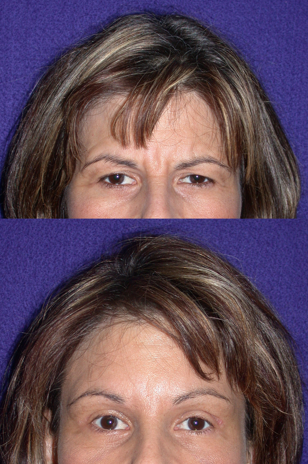 Before (above) and after photos of a 43-year-old female