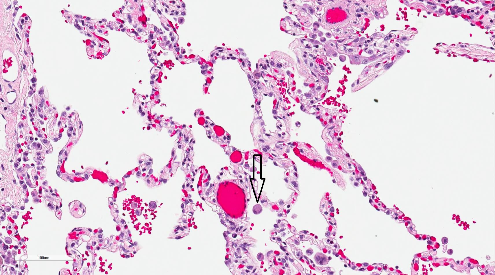<p>Lung Histology 200x Magnification</p>
