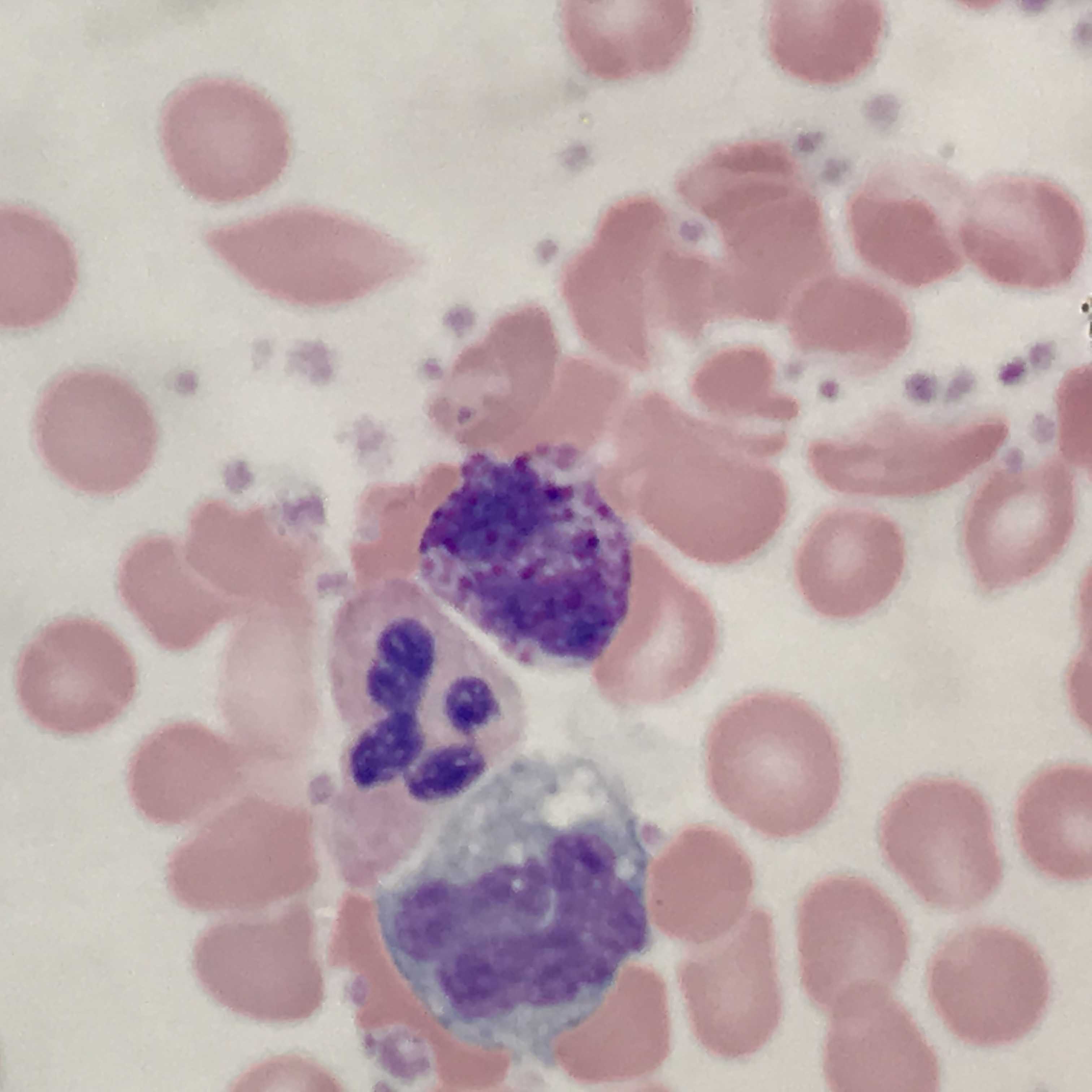 <p>Basophil (center) With Adjacent Neutrophil and Monocyte</p>