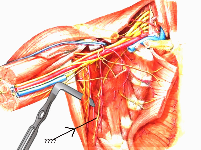 Long thoracic nerve