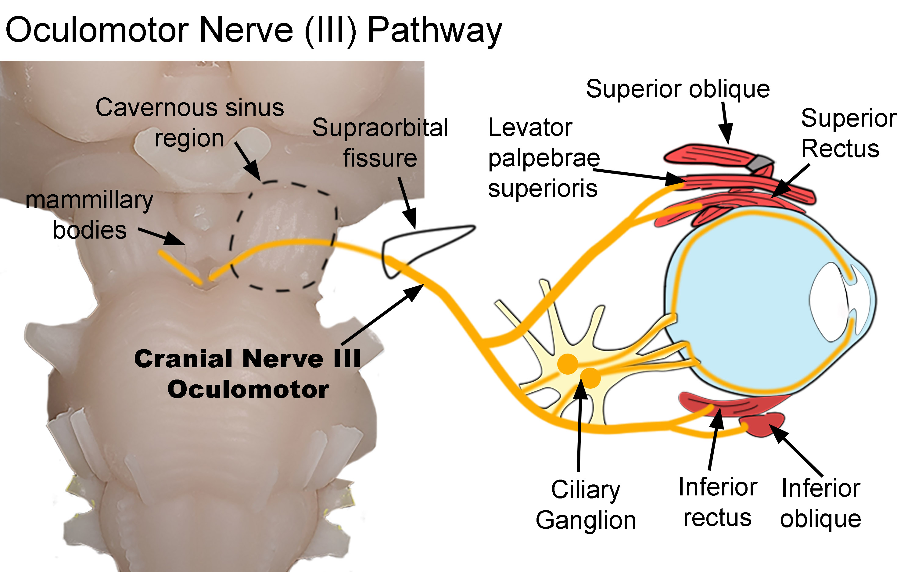 Pathway of the Oculomotor Nerve (III)