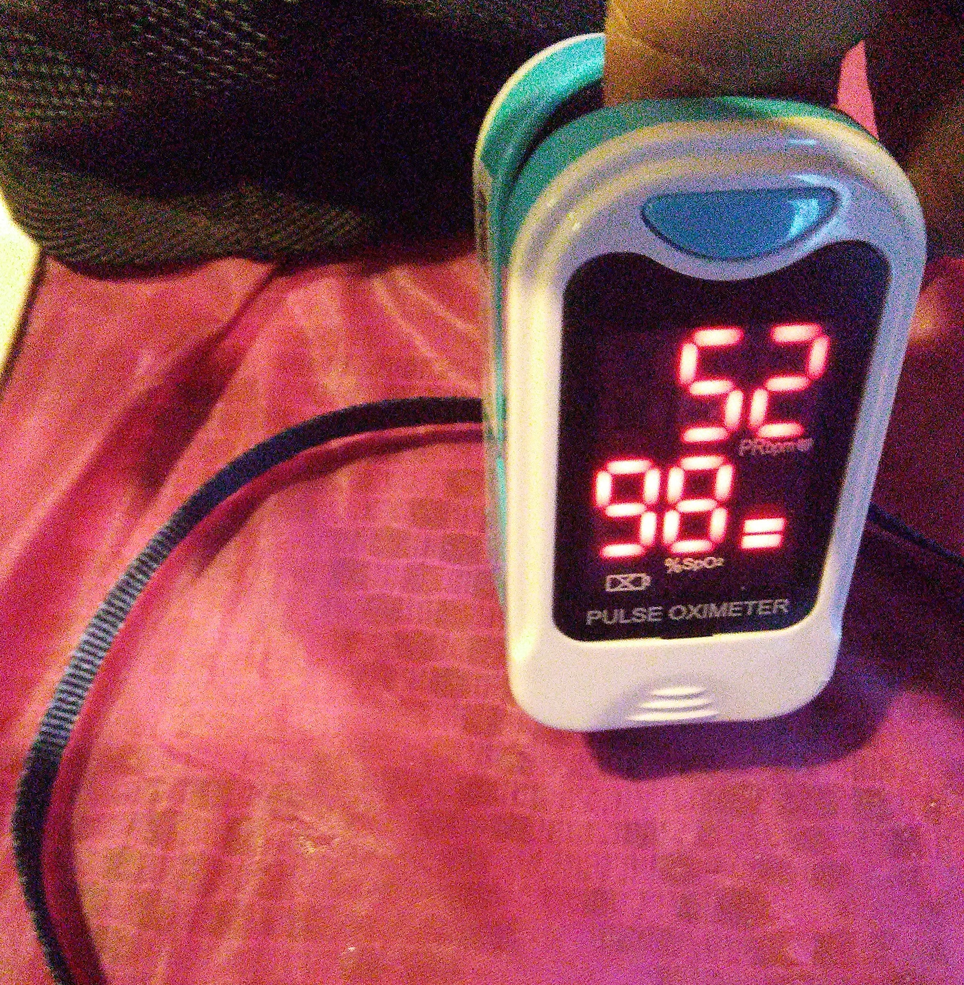 <p>Pulse Oximeter. An image of a pulse oximeter showing 98% oxygen saturation level and a heart rate of 52 bpm.</p>
