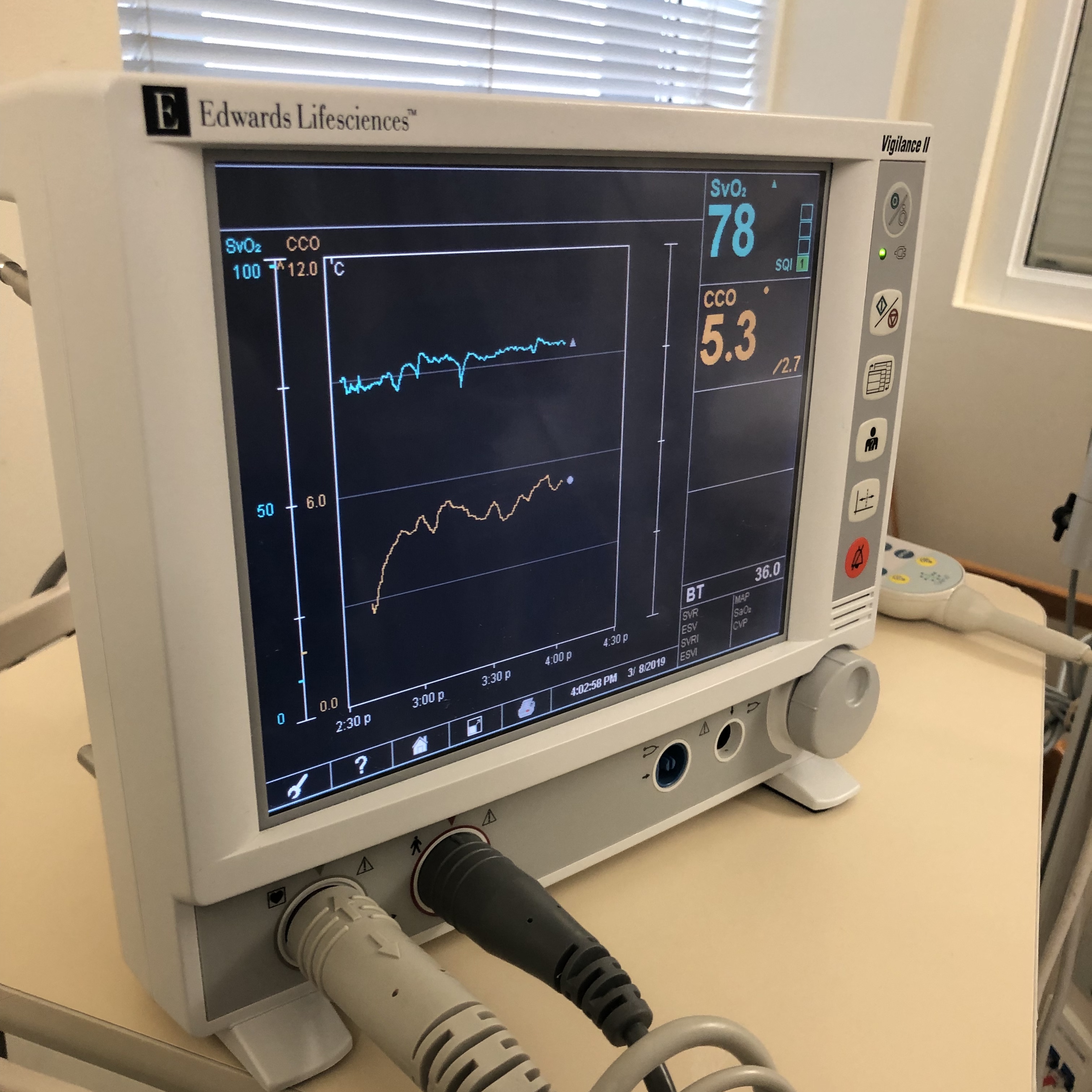 <p>Monitor&nbsp;Shows a Mixed Venous Oxygen Saturation Value