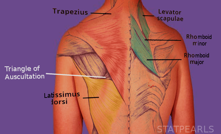 <p>Triangle of Auscultation
