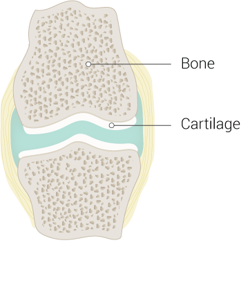 <p>Cartilage and Bone Illustration</p>