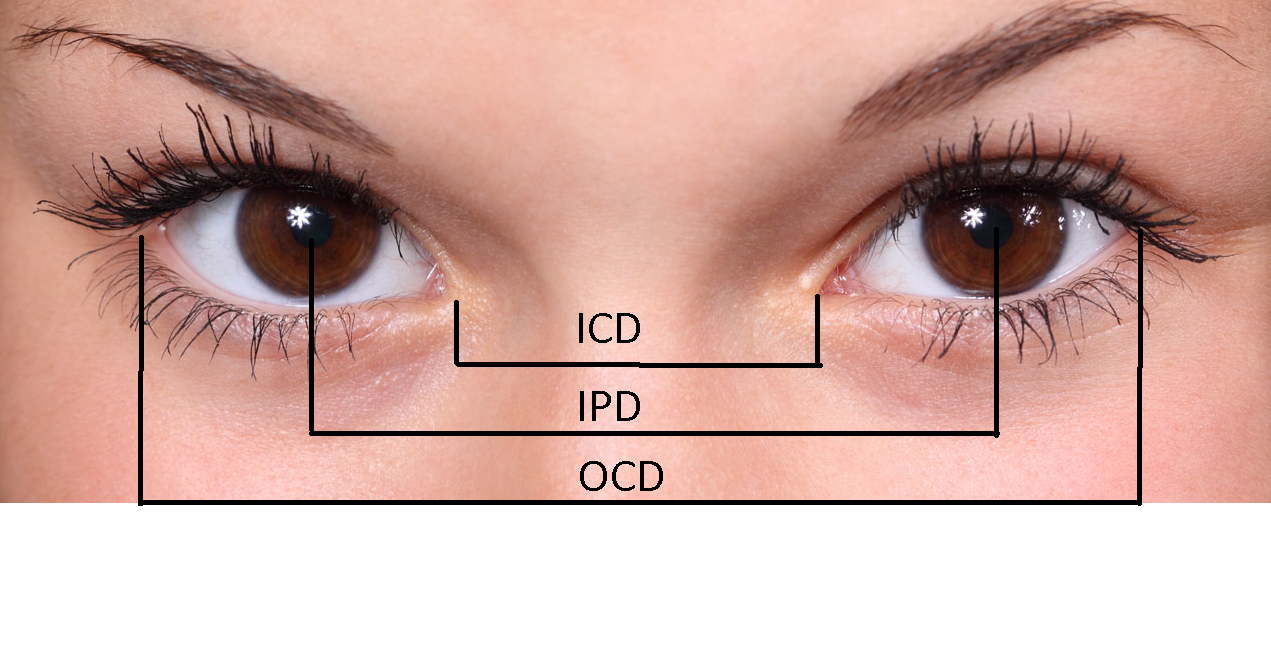 Landmarks for measuring intercanthal distance (ICD), interpupillary distance (IPD) and outer canthal distance (OCD).