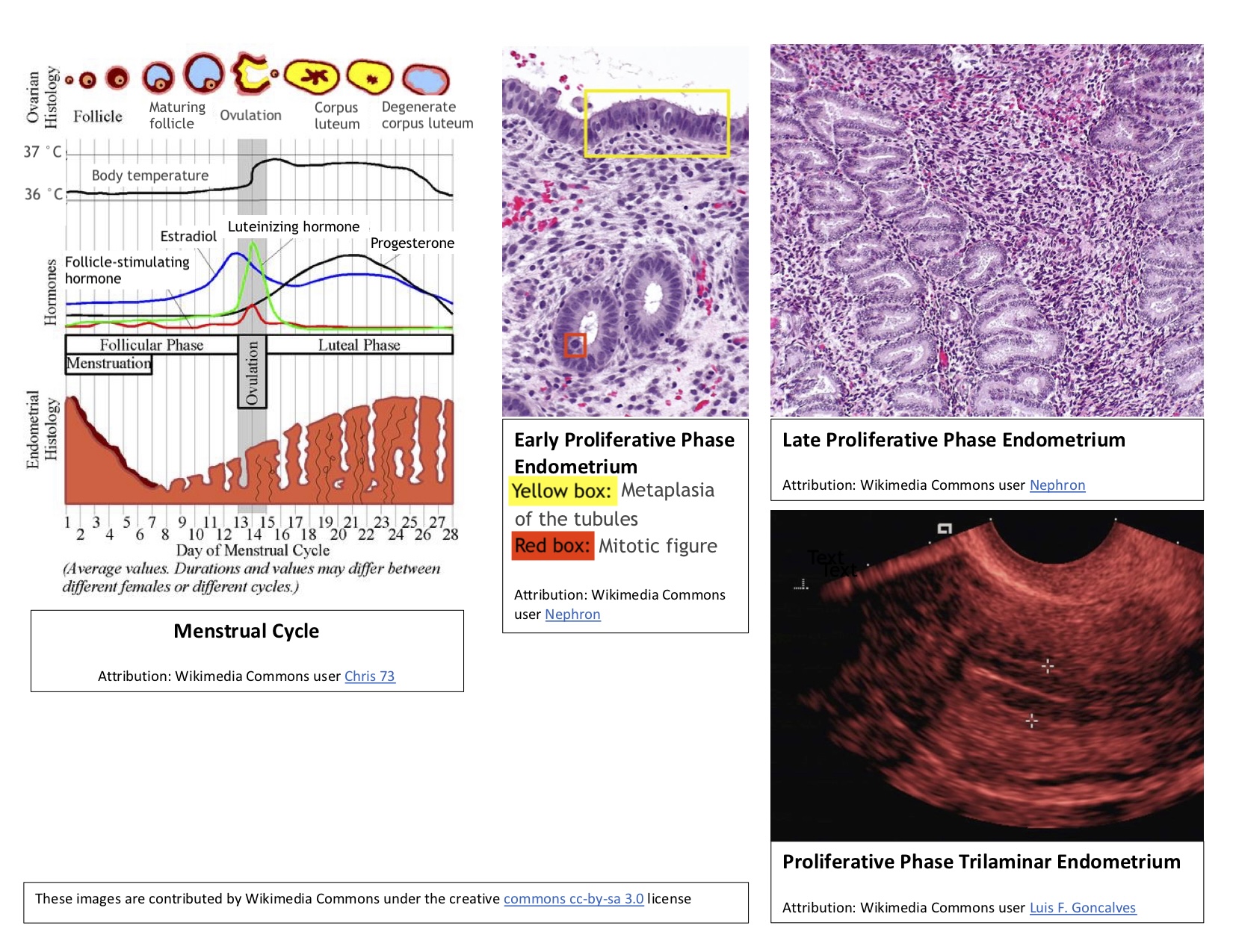 Menstrual Cycle Proliferative And Follicular Phase Article