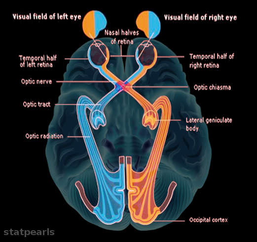 Neuroanatomy, Bitemporal Hemianopsia | Treatment & Management | Point ...