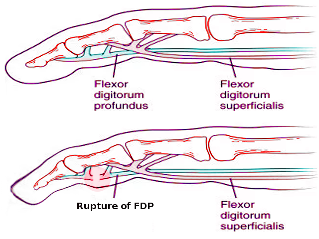 Montagem vozes profundus