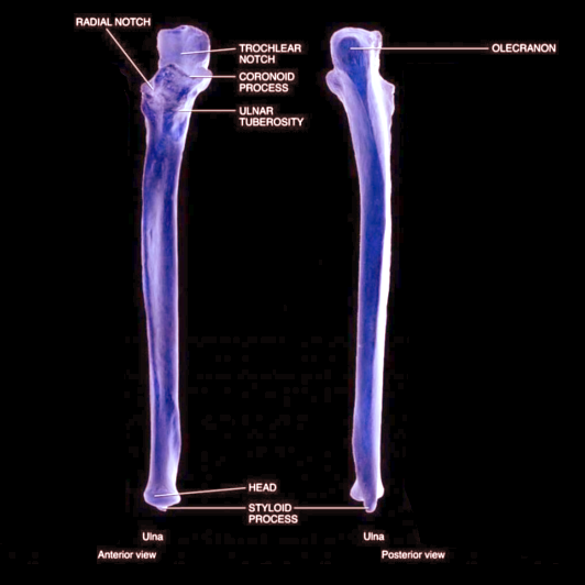 Anatomy, Shoulder and Upper Limb, Forearm Ulna Article