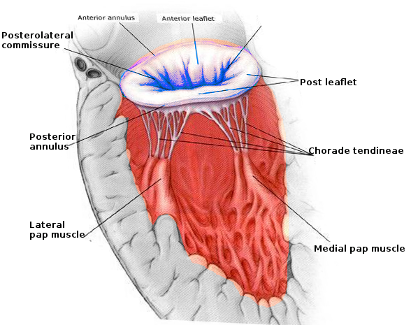 Mitral Valve Repair Article