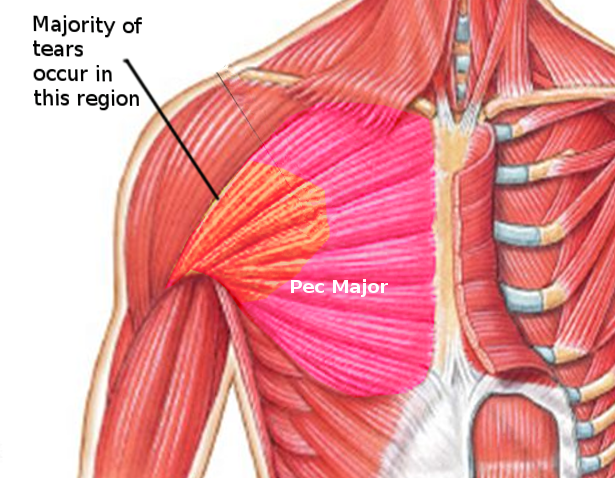 bicep-tendon-tear-info-florida-orthopaedic-institute