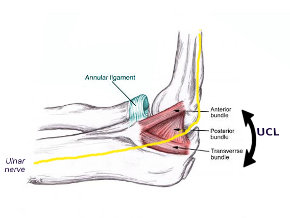 Medial Epicondyle Injection Article