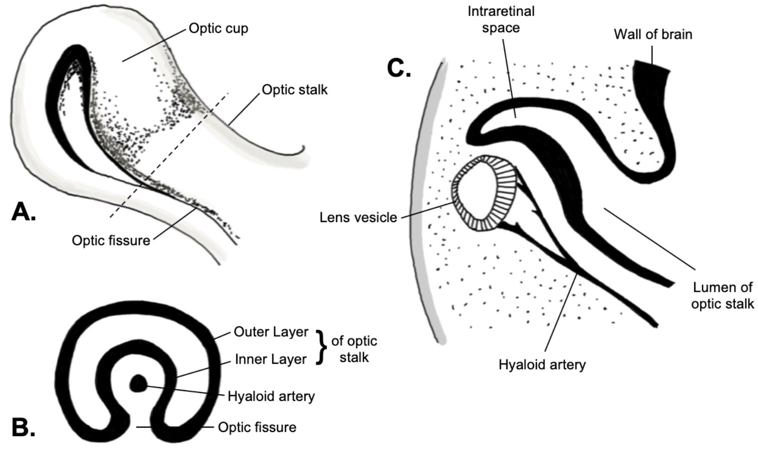 Embryology, Optic Fissure Article