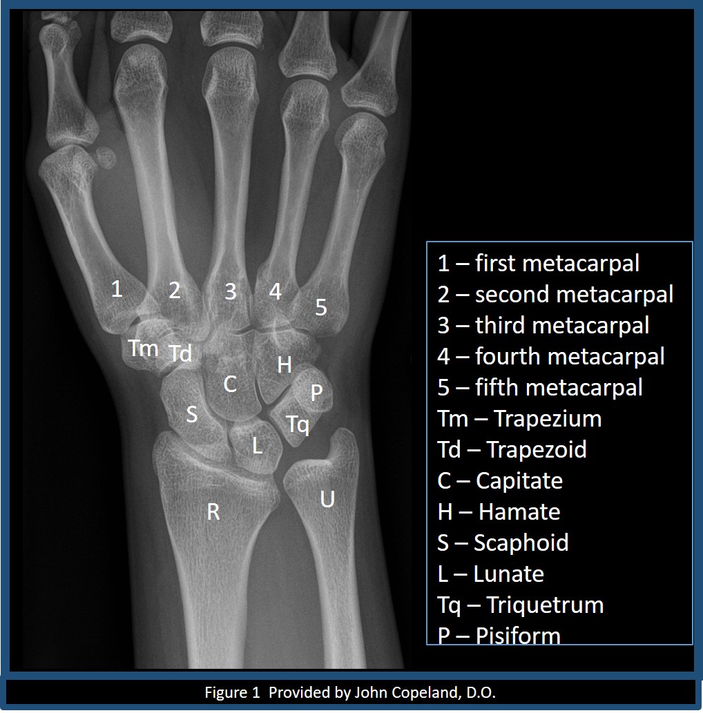 Wrist Imaging Article