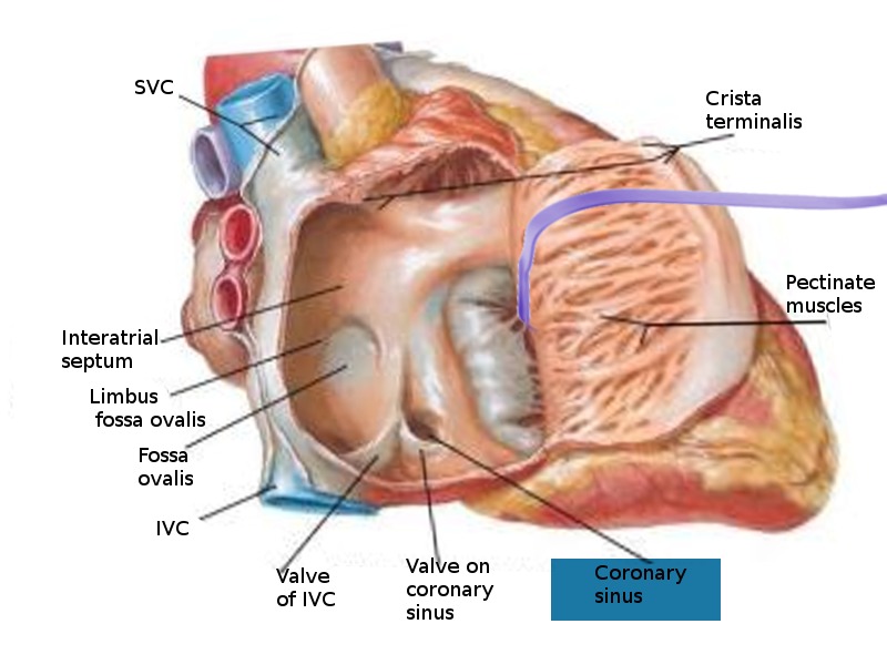 Anatomy, Thorax, Coronary Sinus Article