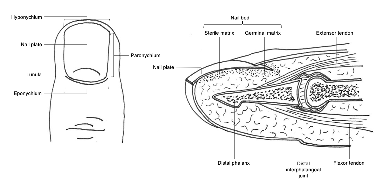 Paronychia Drainage Article