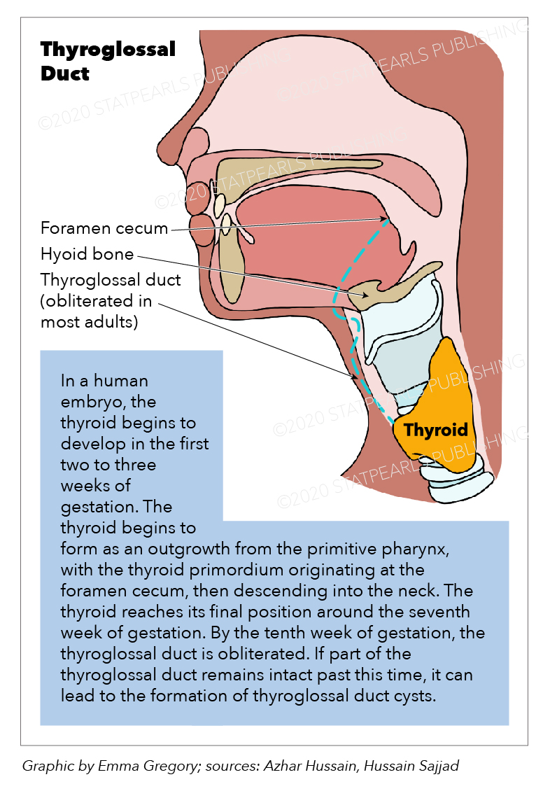 Anatomy, Head And Neck, Thyroid Thyroglossal Duct Article