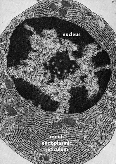 Histology, Rough Endoplasmic Reticulum Article