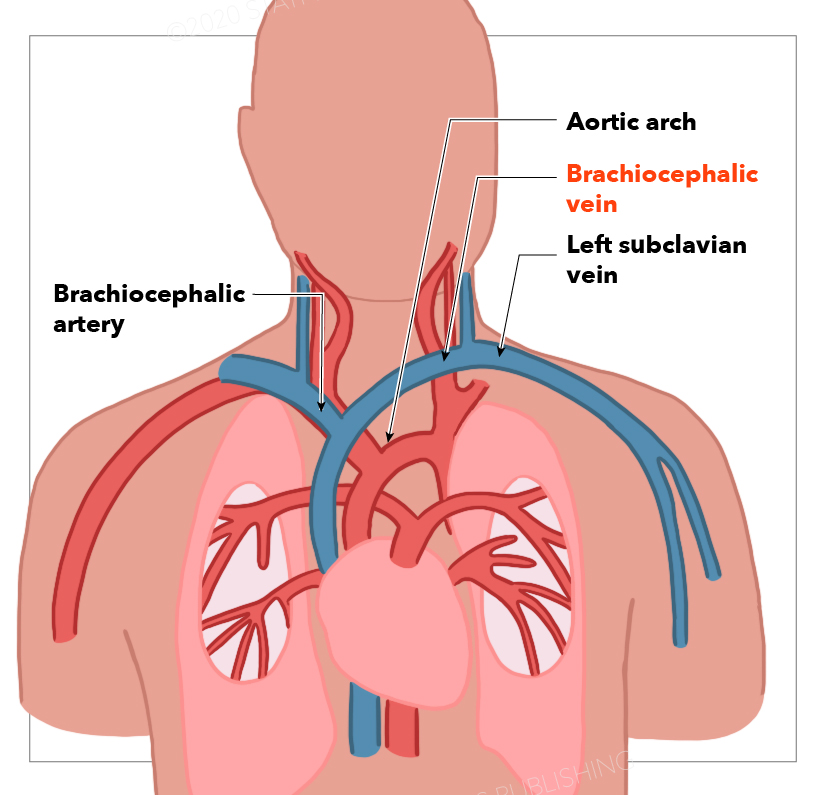 Anatomy Thorax Brachiocephalic Innominate Veins Article