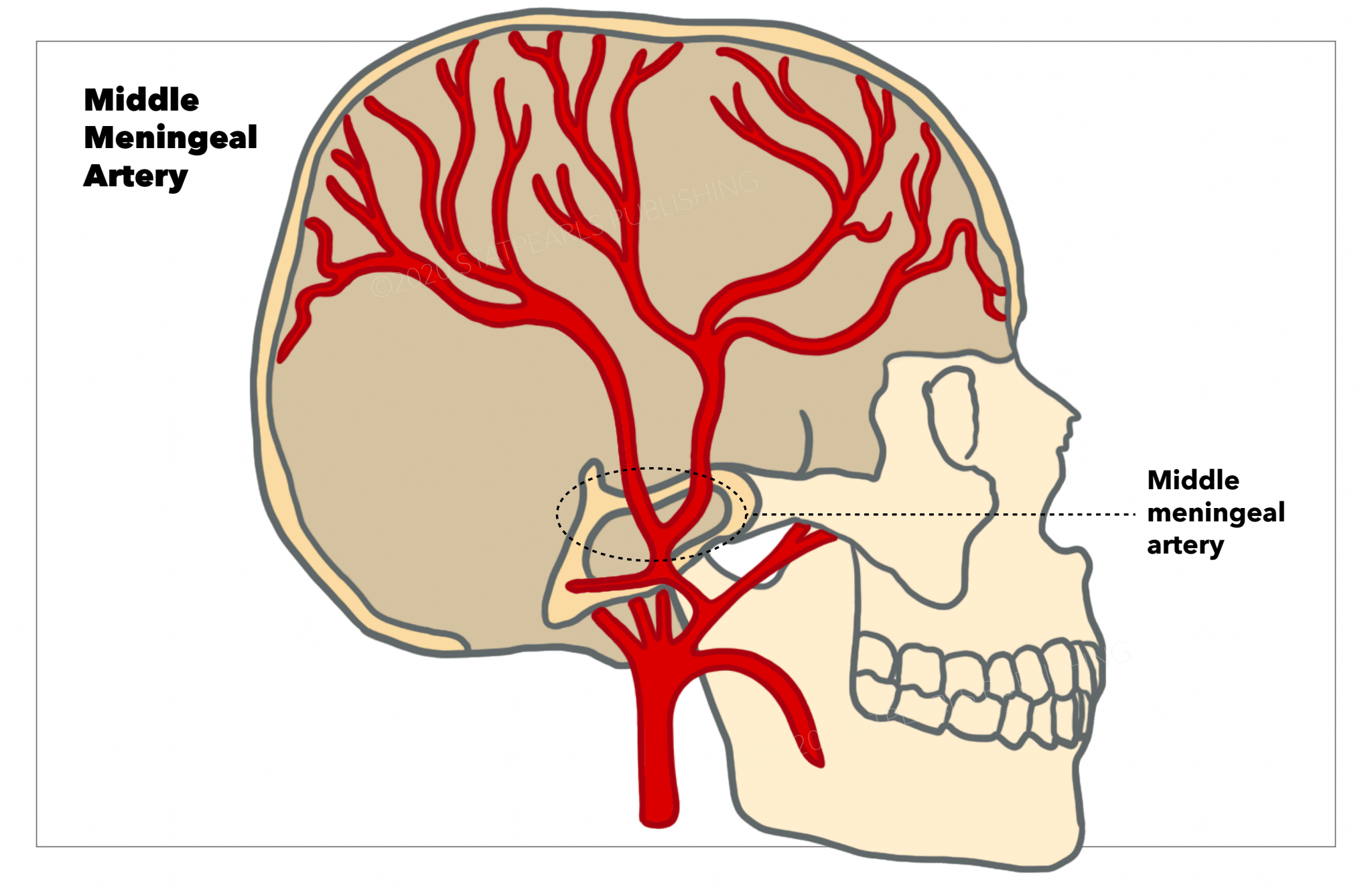 Neuroanatomy, Middle Meningeal Arteries Article